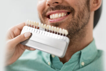 Things to Know Before Getting Dental Veneers