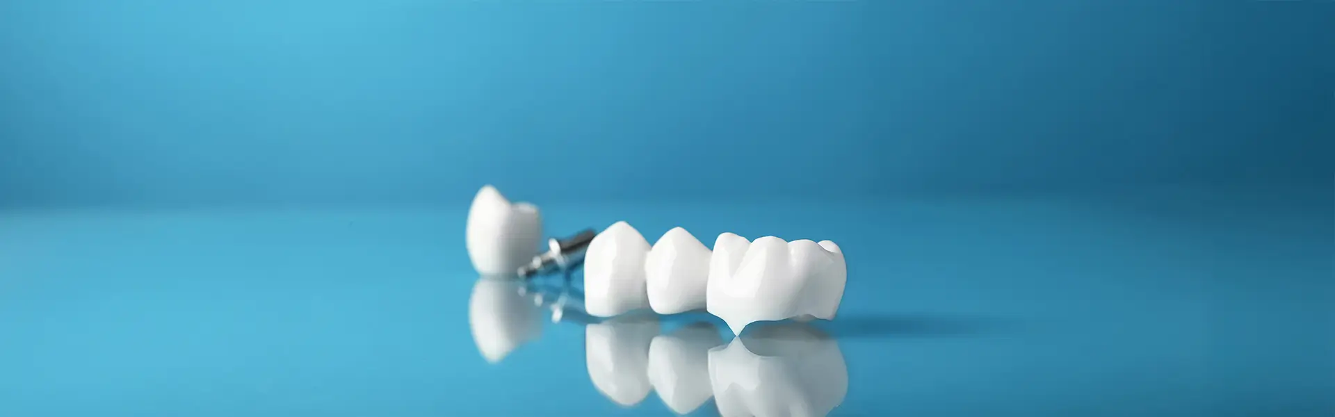 How to Care for Dental Crowns for Long-Term Success